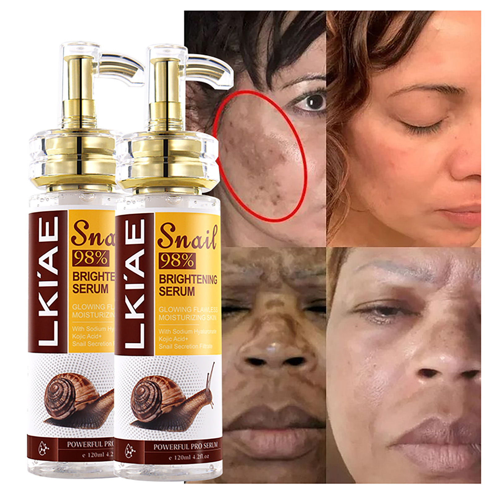 Snail Mucin Essence - AILKE Snail Extract Whitening Serum, Moisturizing,