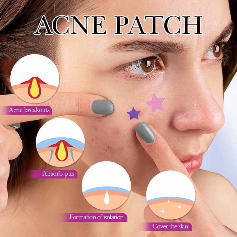 7/10/14Pcs Colorful Star Acne  - Skincare Qv reseña y precio
