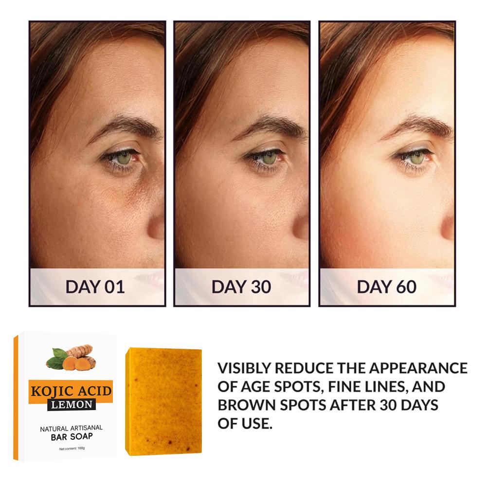 Newly upgrade Turmeric Kojic A - Kojic Acid Soap reseña y precio