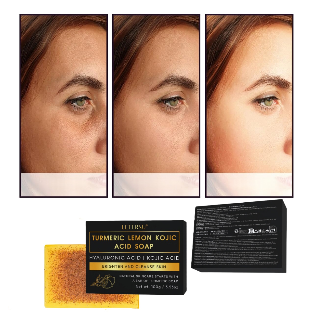 Turmeric Lemon Kojic Acid Soap - Kojic Acid Soap reseña y precio