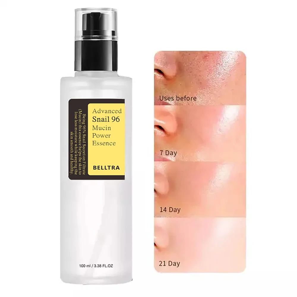 Snail mucin 96% Korean skin ca - Snail Mucin Essence reseña y precio