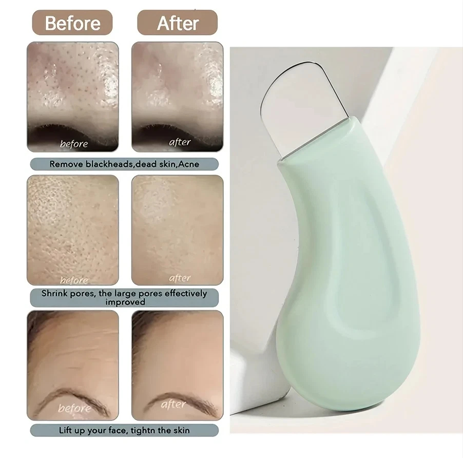 Professional Blackhead and Whi - Skincare Qv reseña y precio