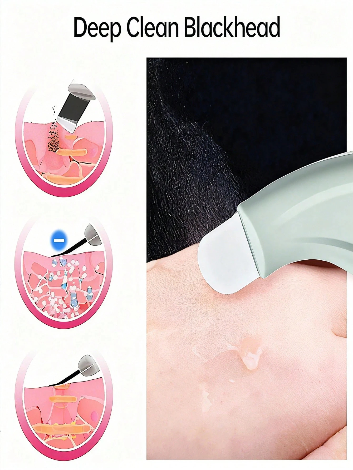 Professional Blackhead and Whi - Skincare Qv reseña y precio