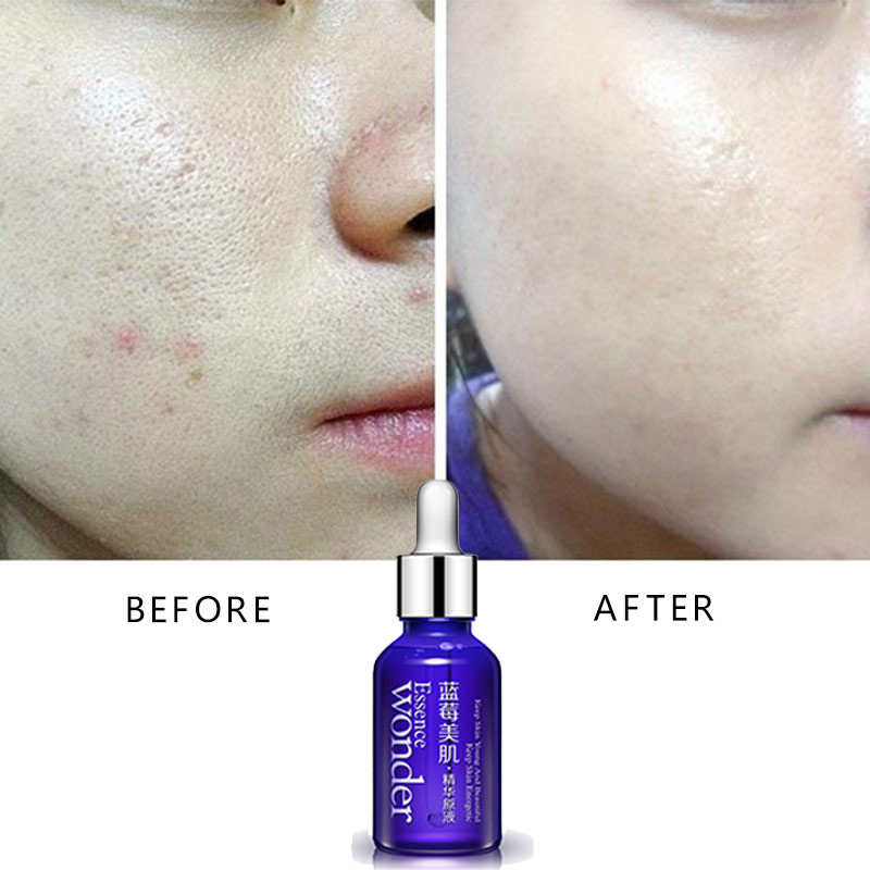 BIOAQUA Blueberry Face Lifting - Skincare Garnier reseña y precio