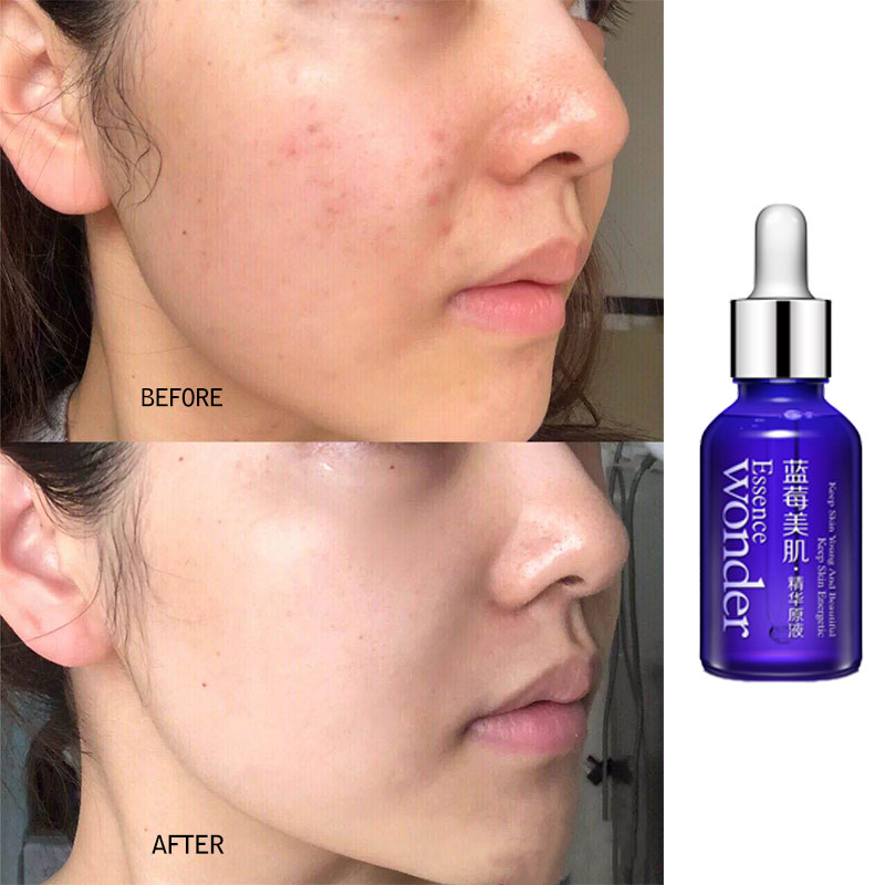 BIOAQUA Blueberry Face Lifting - Skincare Garnier reseña y precio