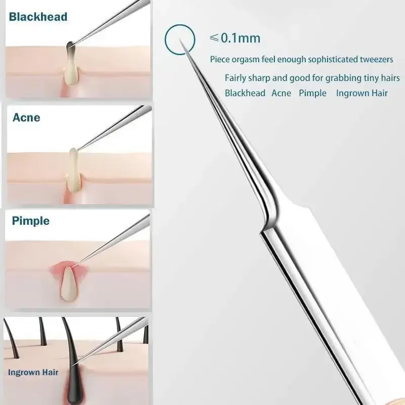 11Pcs/Set Acne Needle Blackhea - Skincare Qv reseña y precio