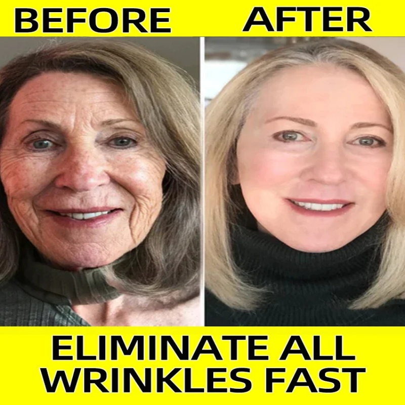 Anti-aging serum Neck wrinkle  - Skincare Garnier reseña y precio