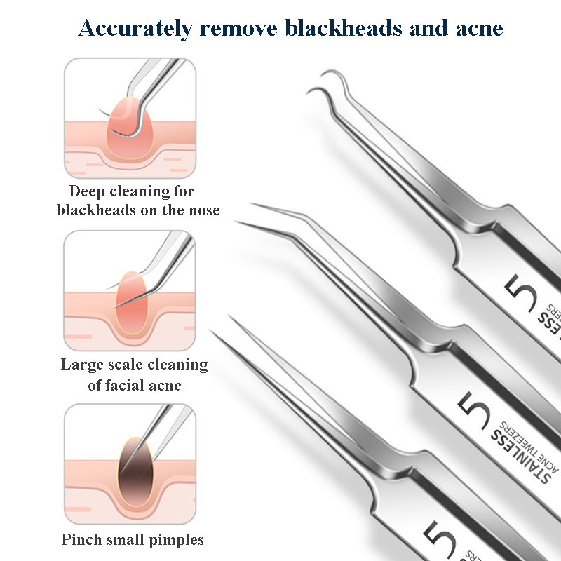 4-11Pcs Ingrown Hair Tweezers  - Skincare Qv reseña y precio