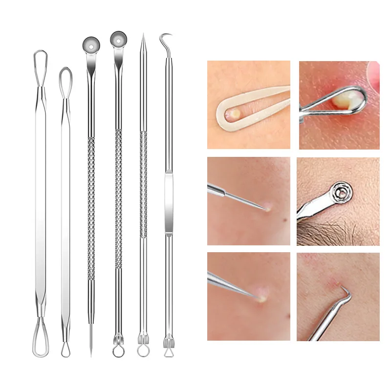4-11Pcs Ingrown Hair Tweezers  - Skincare Qv reseña y precio