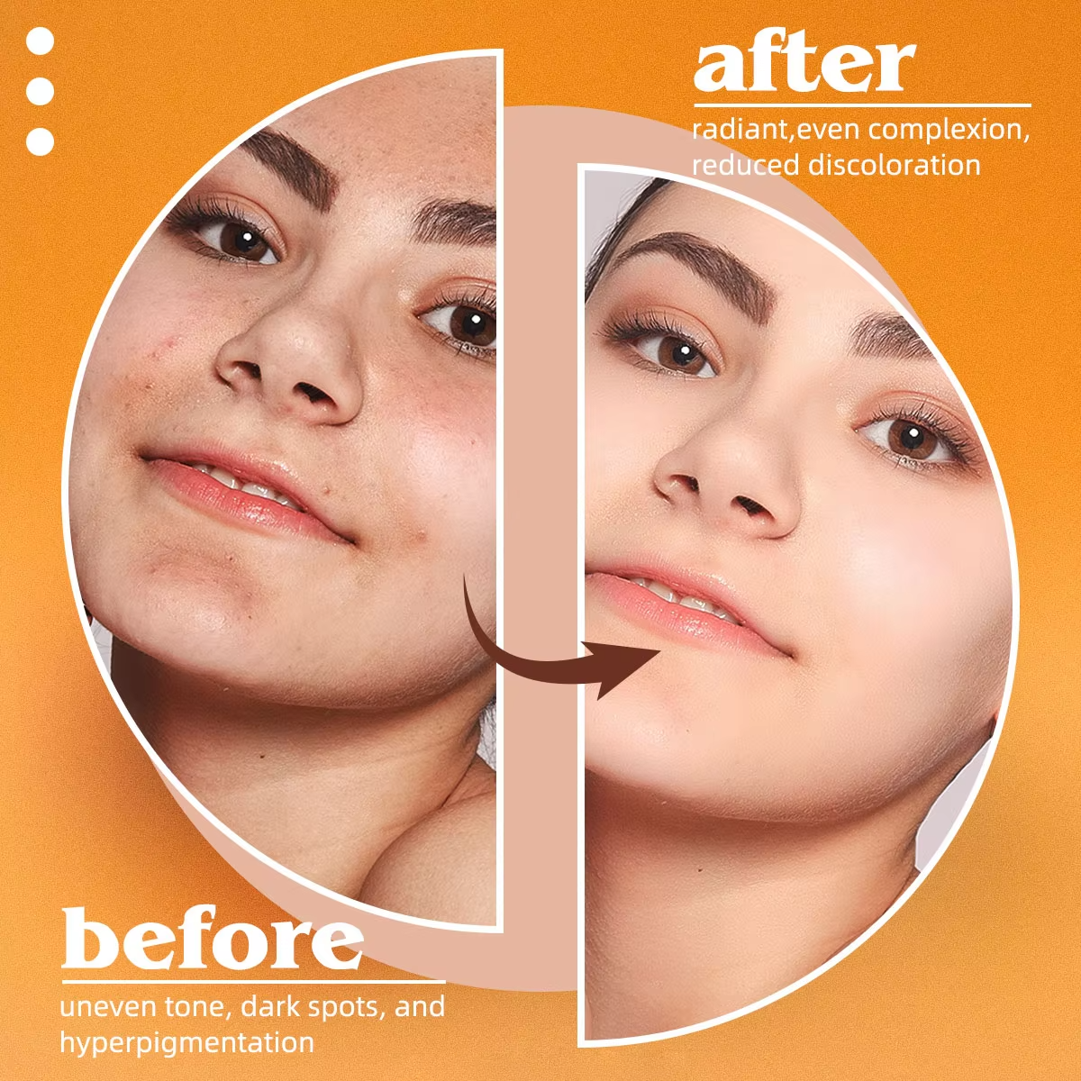 Kojic Acid Natural Papaya Soap - Kojic Acid Soap reseña y precio