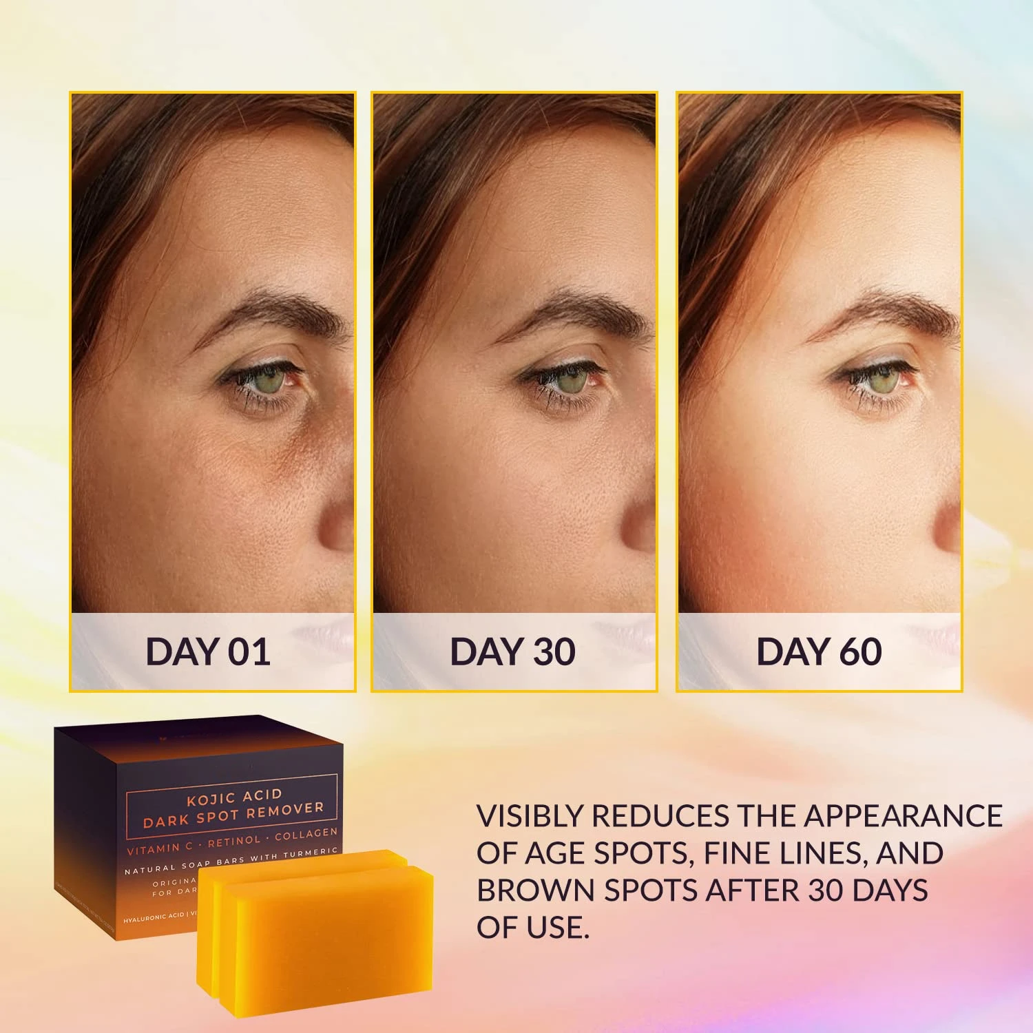 Kojic Acid Dark Spot Remover W - Kojic Acid Soap reseña y precio