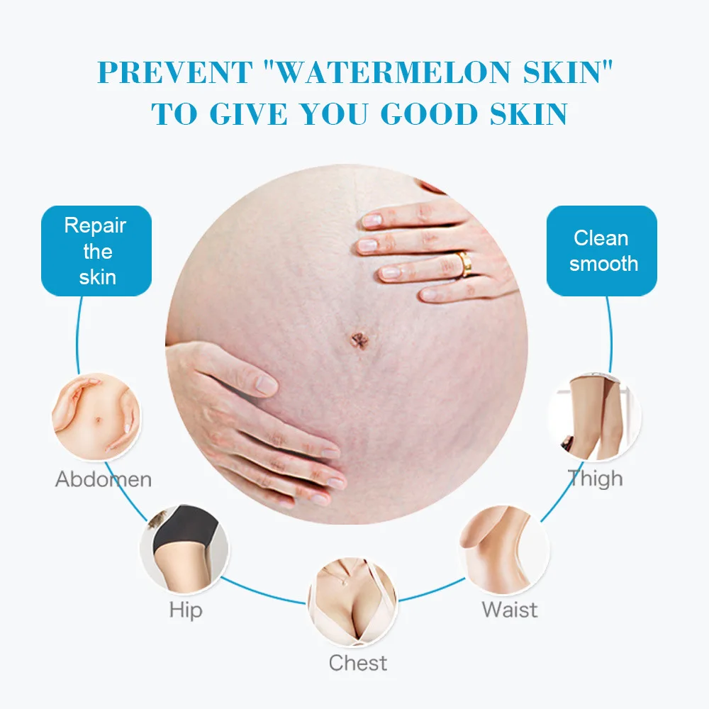 Snail Removes Stretch Mark Cre - Snail Cream Gel reseña y precio